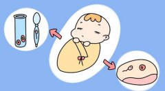 在天津武清区借卵生子中心借卵流程跟注意事项是什么