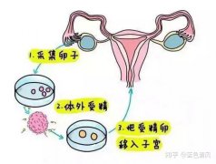 重庆云阳县怎样选择正规的供卵机构？