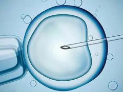 上海徐汇区助孕中心供卵生孩子哪家机构靠谱？