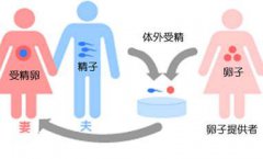 北京房山区第三代试管婴儿成功率有多少？